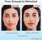 Grace & Stella Acne & Redness Mist