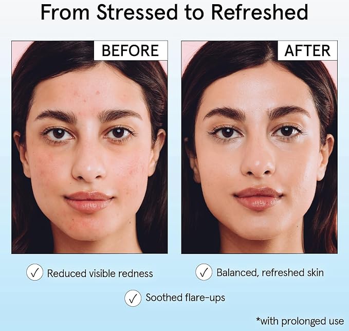 Grace & Stella Acne & Redness Mist